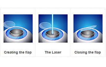 zyoptics Management in Jalandhar zyoptics Management